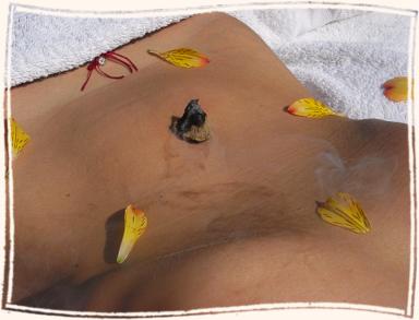 Moxibustion